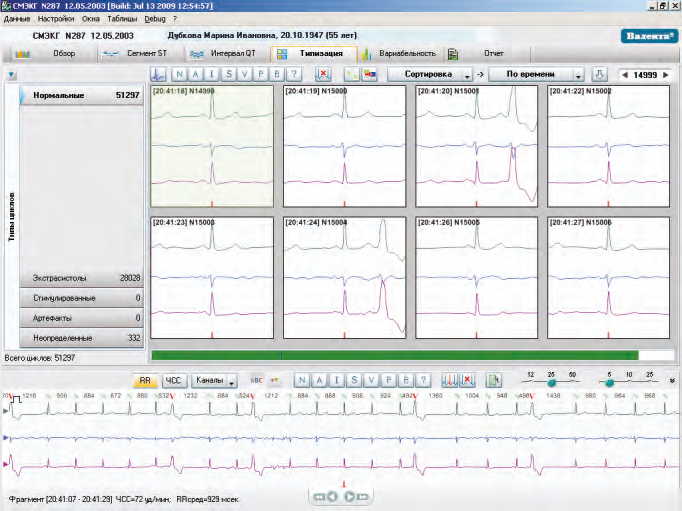 Холтер ЭКГ Валента 12-ти канальный Santreyd MED-37 - Вид №5